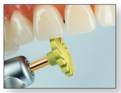 Pulidor aspas de composite: TopGloss 20039RA pulido alto brillo (6 uds) - Imagen 2