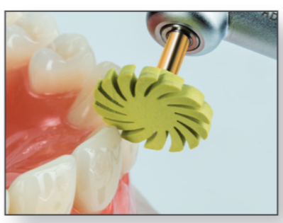 Pulidor aspas de composite: TopGloss 20039RA pulido alto brillo (6 uds) - Imagen 3